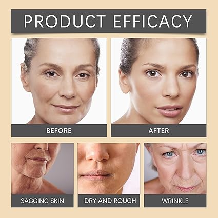 OUHOE - Bee Venom Botox Wrinkle Cream (Originalo]